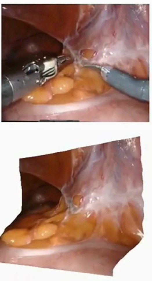 Case 1: input with tools above, tool-free 3D reconstruction below