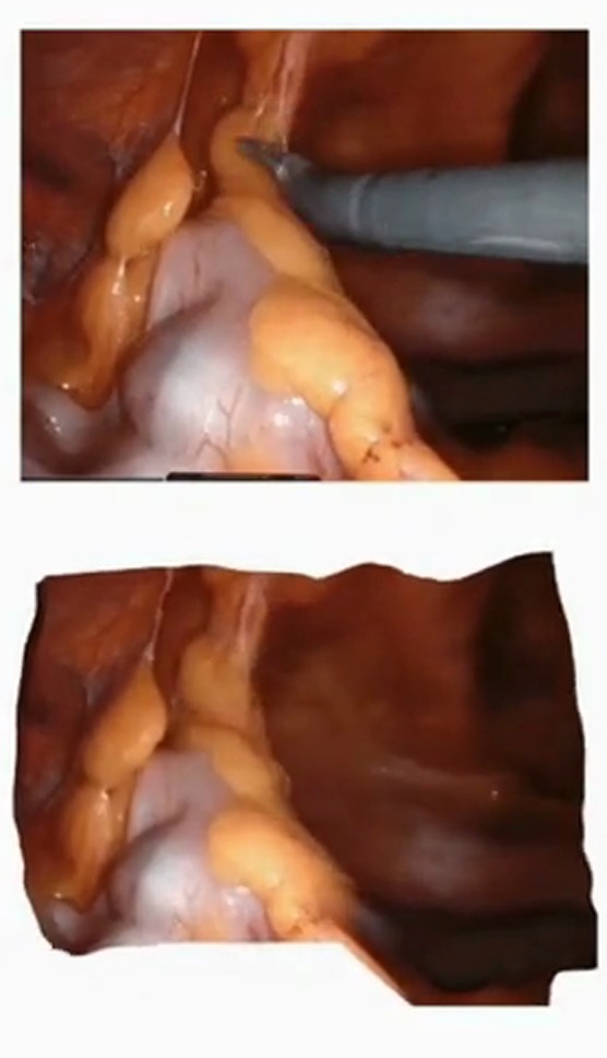 Case 2: input with tools above, tool-free 3D reconstruction below