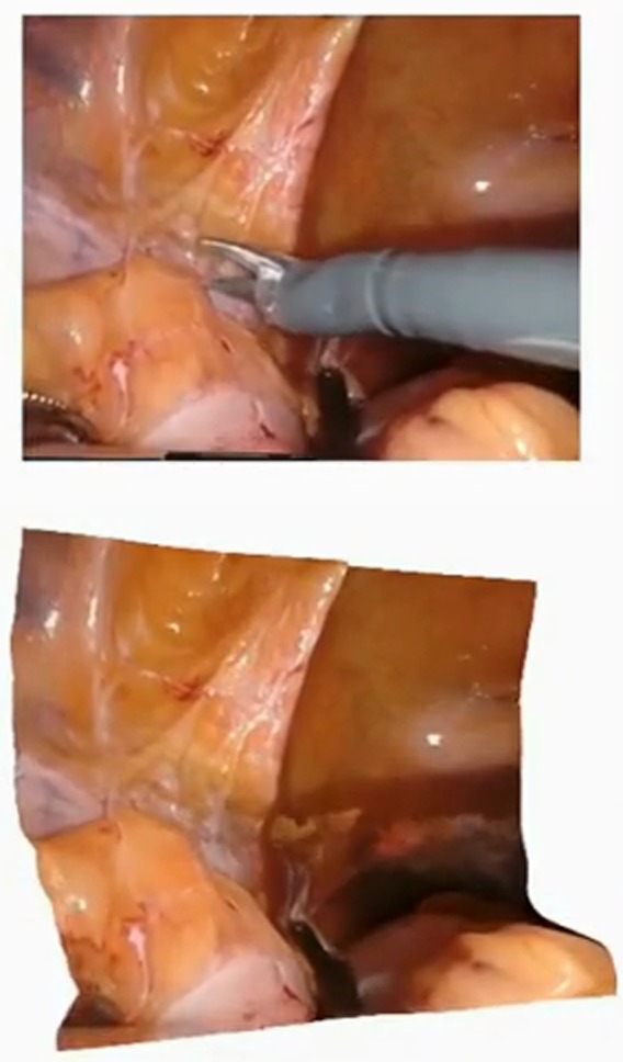 Case 3: input with tools above, tool-free 3D reconstruction below
