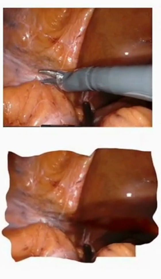 Case 4: input with tools above, tool-free 3D reconstruction below