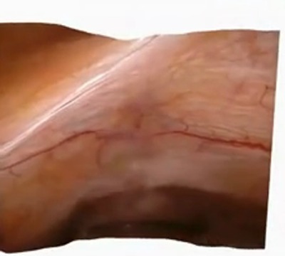 PhysioSplat reconstruction, case 2