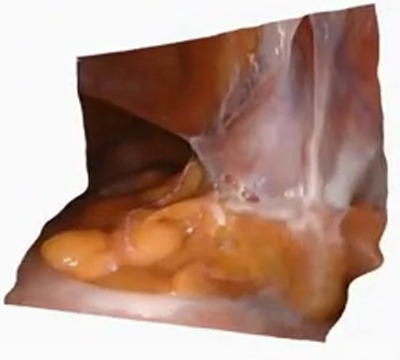 PhysioSplat reconstruction, case 3