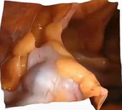 PhysioSplat reconstruction, case 1
