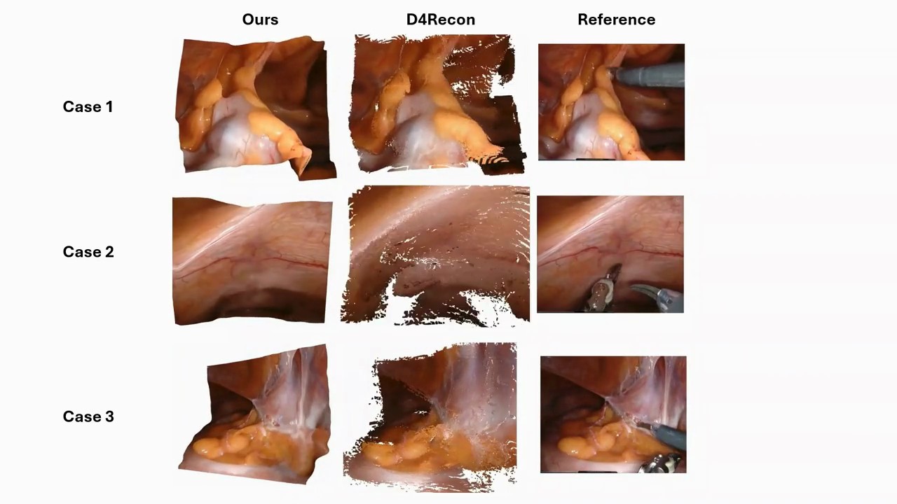 Ours vs D4Recon vs Reference